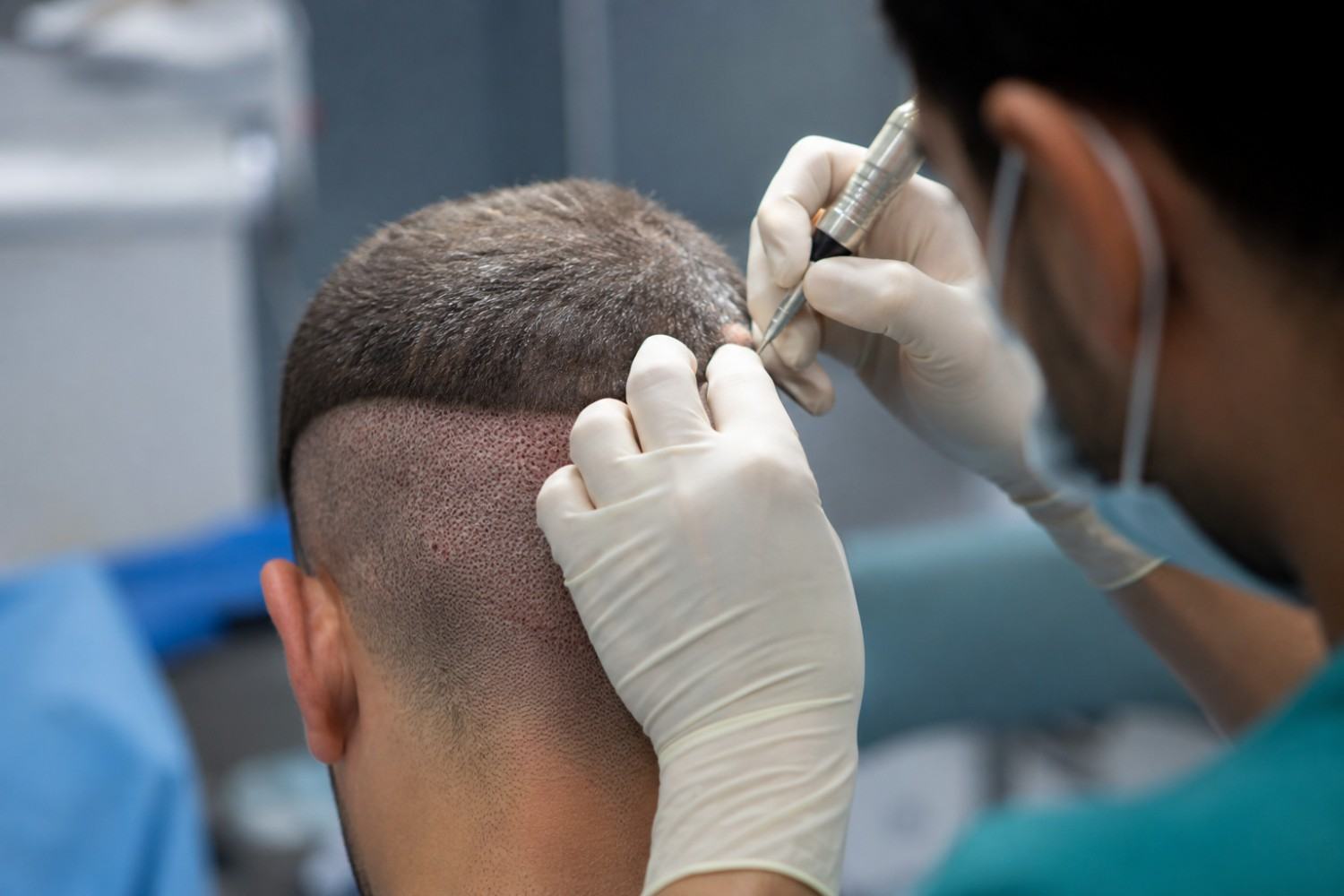 minimally invasive fue procedures guide